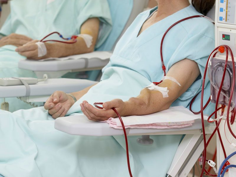 Dialysis