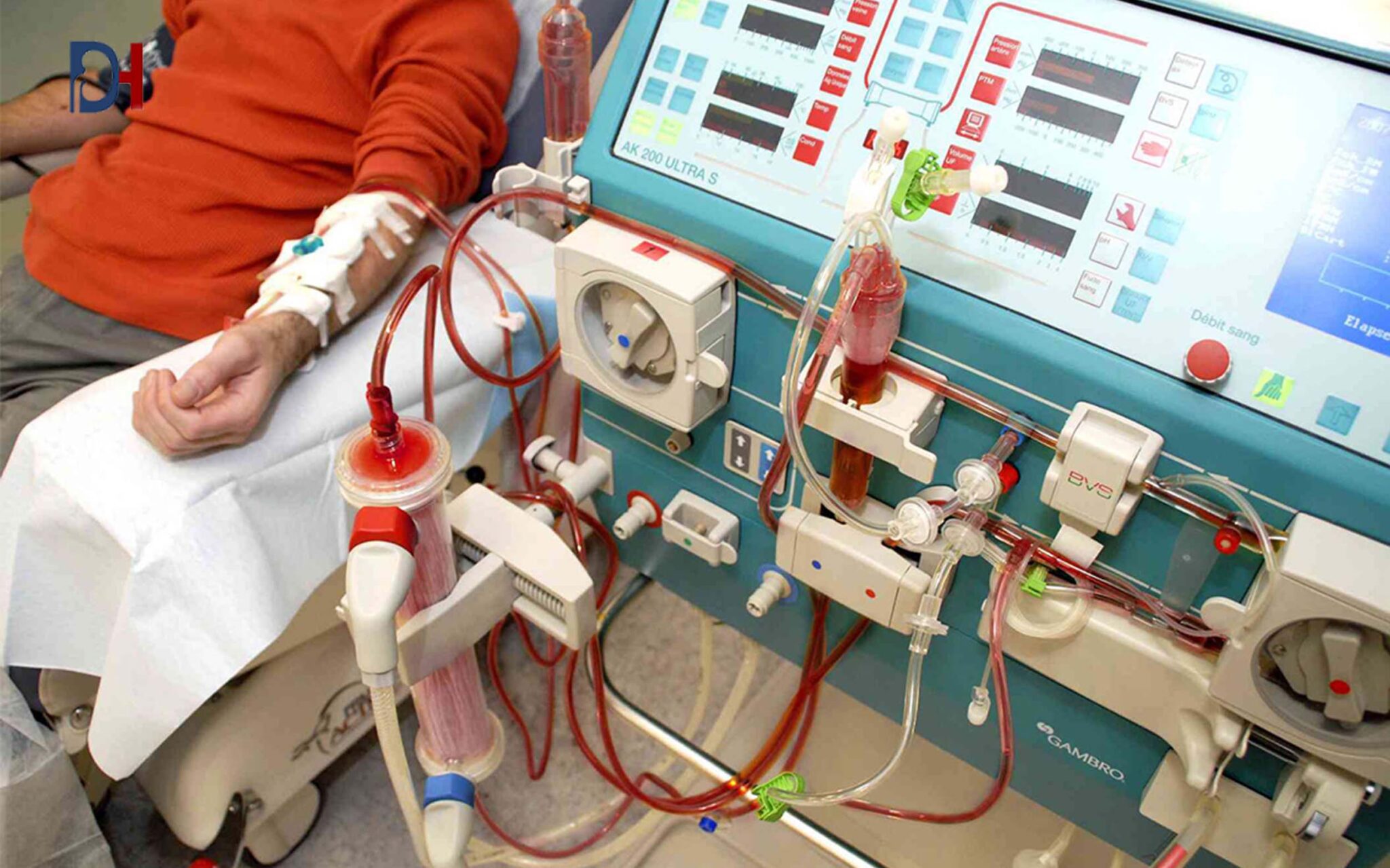 dialysis
